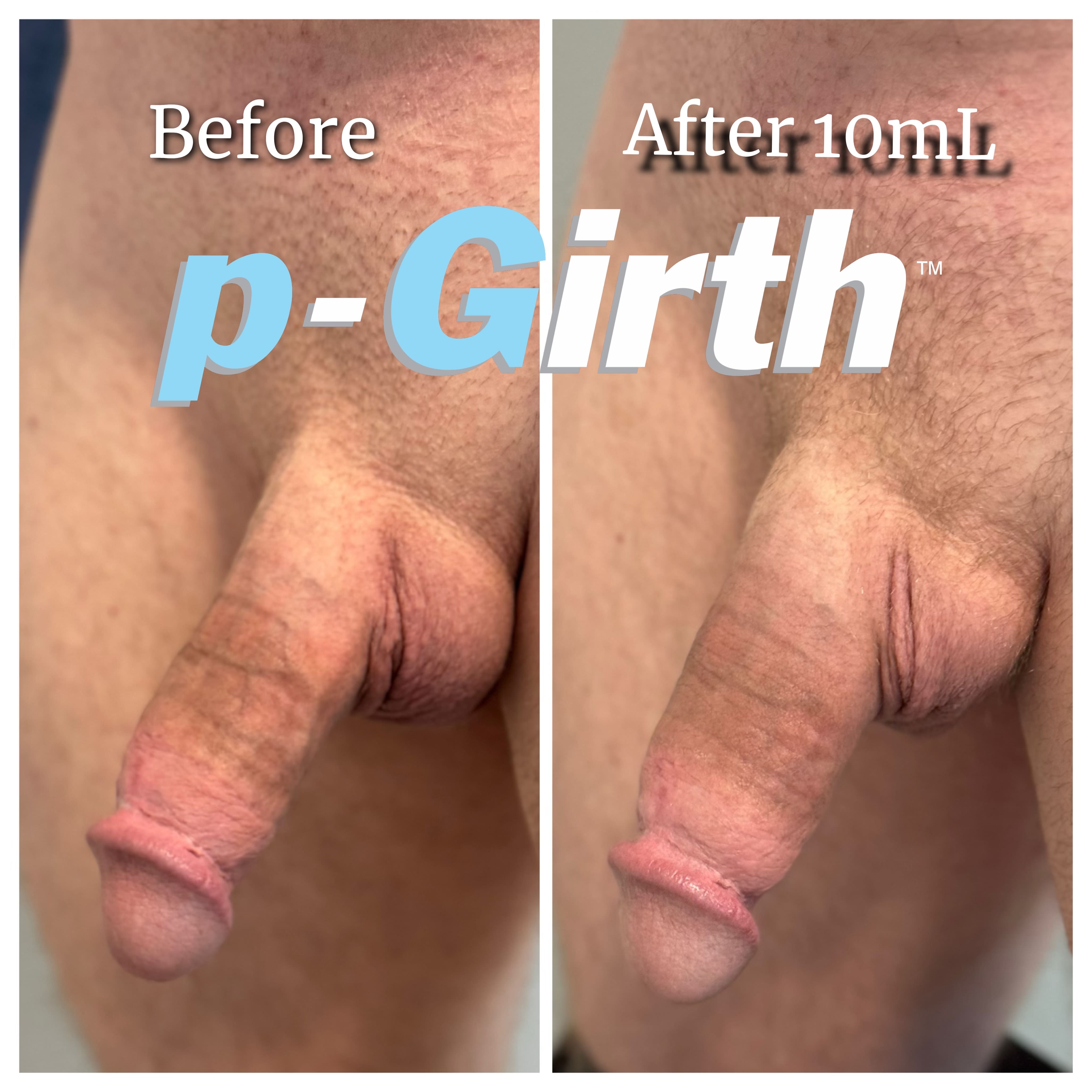 10mL2 min