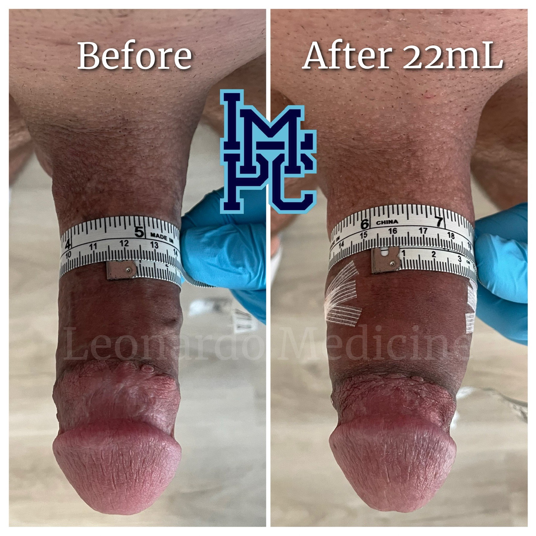 20mL4