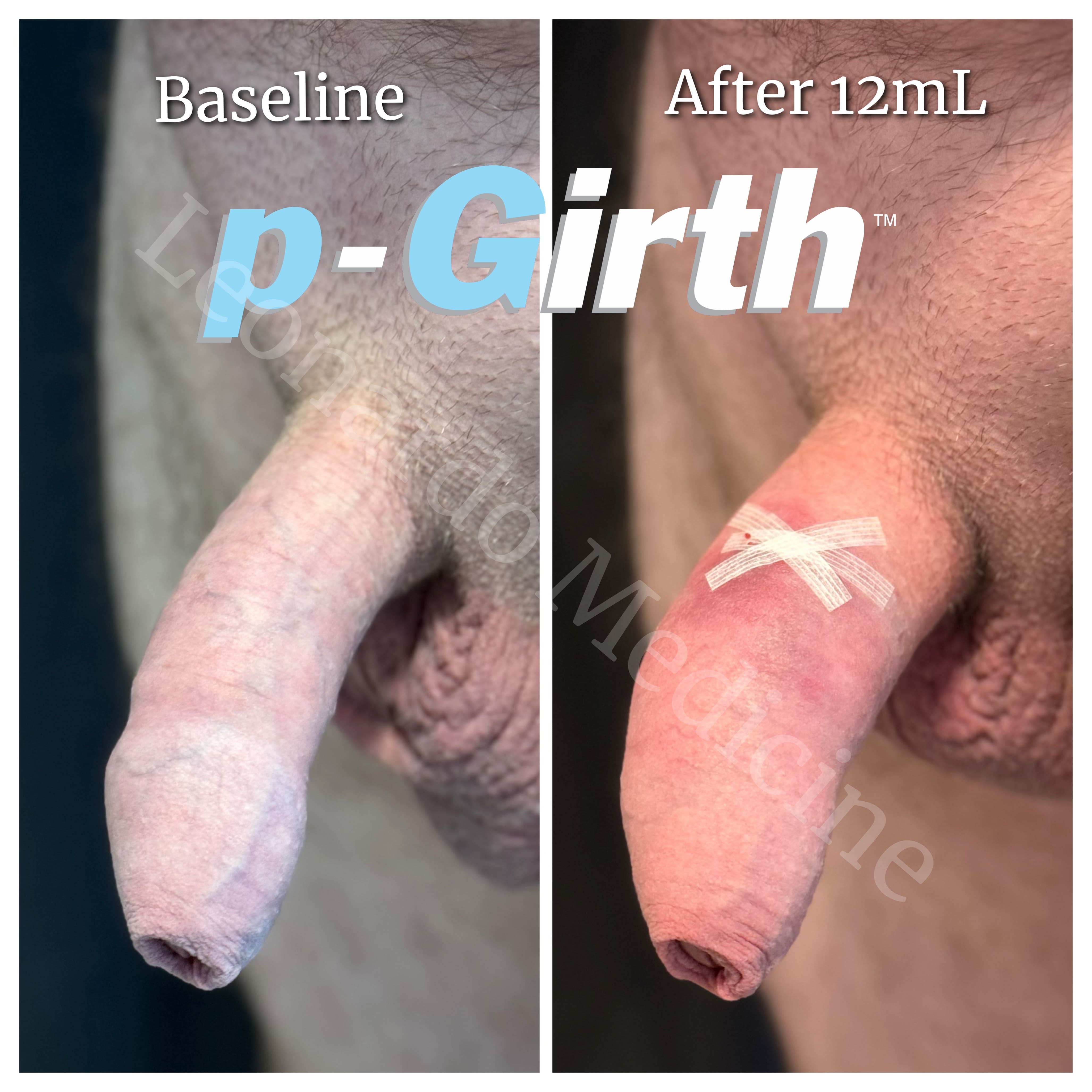 CF38B9B6 1CF6 4181 A651 DD7060119E68 min